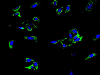 Anti-TLR1 TRIM6 Antibody