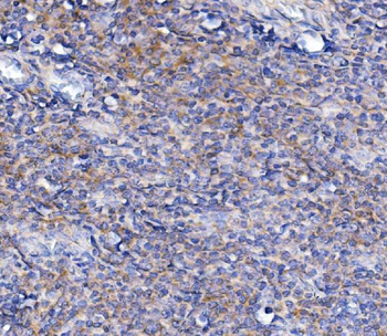 Anti-TLR1 TRIM6 Antibody