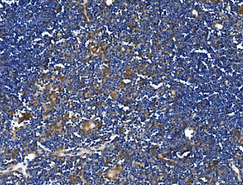 Anti-TLR1 TRIM6 Antibody