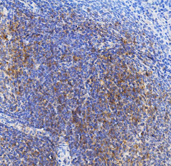 Anti-TLR1 TRIM6 Antibody
