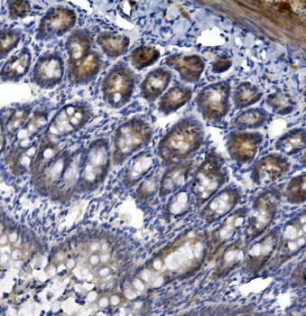 Anti-TTK/Mps1/TTK Antibody