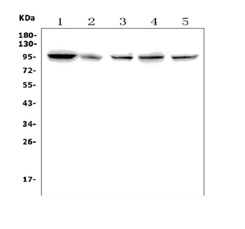 Anti-TTK/Mps1/TTK Antibody