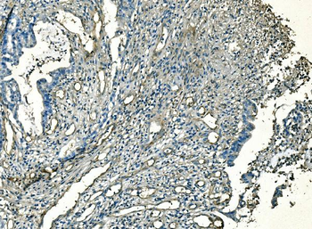 Anti-CD59 Antibody (monoclonal, 3C10)