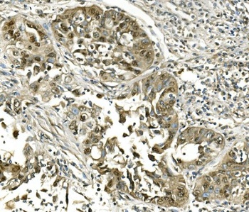Hsc70 Antibody(monoclonal, 3B6)