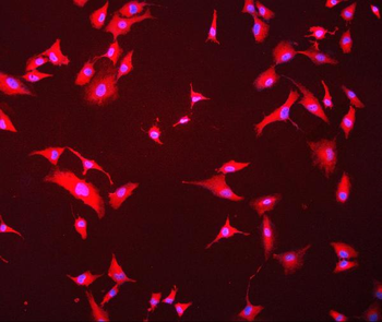 Anti-Hsc70 Antibody (monoclonal, 3B6)