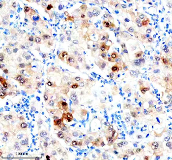 Anti-Hsc70 Antibody (monoclonal, 3B6)