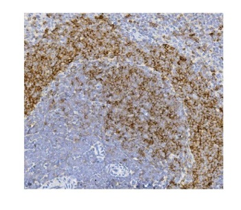 CD79b Antibody(monoclonal, 6H11)