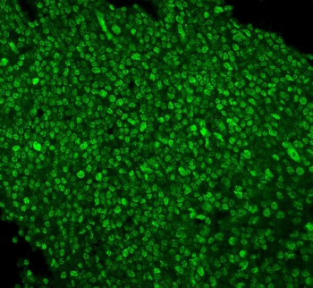 Anti-PTBP1 Antibody (monoclonal, 3H12)