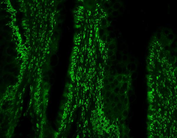 Anti-PTBP1 Antibody (monoclonal, 3H12)