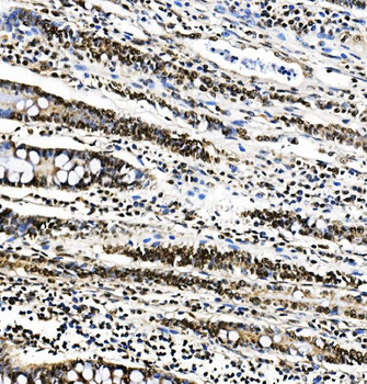 Anti-PTBP1 Antibody (monoclonal, 3H12)