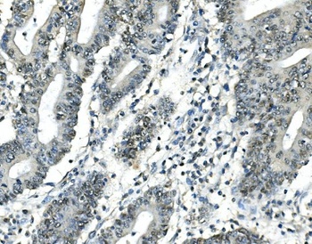 ATF1 Antibody(monoclonal, 7F8)