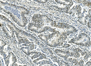 Anti-ATF1 Antibody (monoclonal, 7F8)