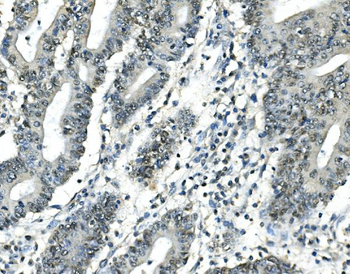 Anti-ATF1 Antibody (monoclonal, 7F8)