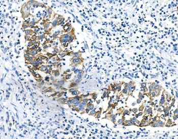 Cytokeratin 18 KRT18 Antibody(monoclonal, 7I6)