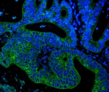 Anti-Cytokeratin 18 KRT18 Antibody (monoclonal, 7I6)