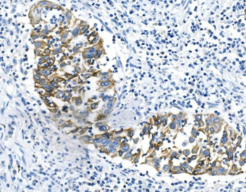 Anti-Cytokeratin 18 KRT18 Antibody (monoclonal, 7I6)