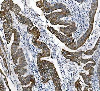 Anti-Cytokeratin 18 KRT18 Antibody (monoclonal, 7I6)