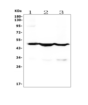 Anti-Cytokeratin 18 KRT18 Antibody (monoclonal, 7I6)