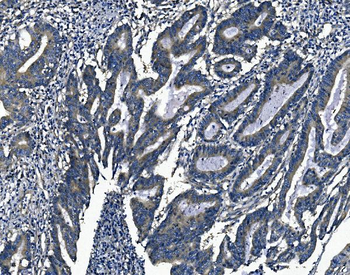 Anti-Agrin/AGRN Antibody
