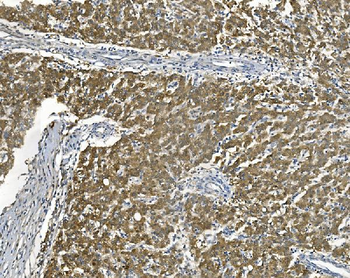 Anti-AKR7A2 Antibody