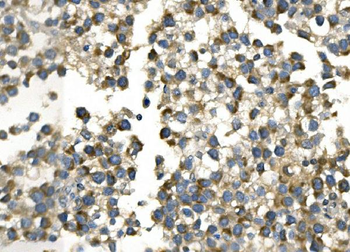 Anti-AKR7A2 Antibody
