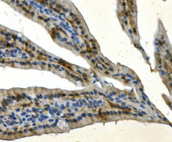 Anti-AKR7A2 Antibody