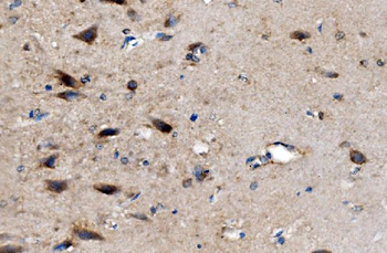 Anti-AKR7A2 Antibody