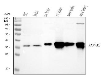Anti-AKR7A2 Antibody