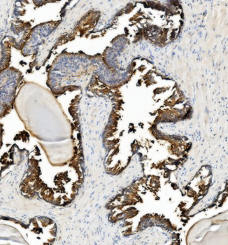 Anti-CD13/ANPEP Antibody