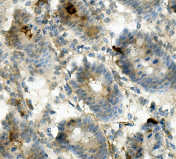 Anti-CD13/ANPEP Antibody