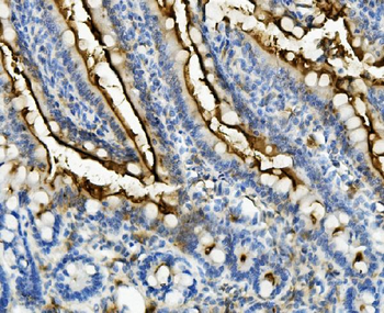 Anti-CD13/ANPEP Antibody
