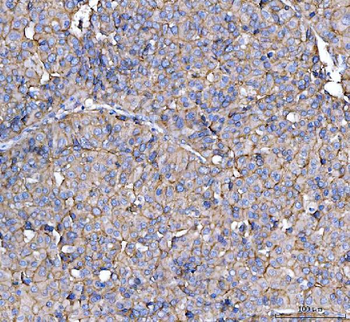 Anti-CD13/Anpep Antibody