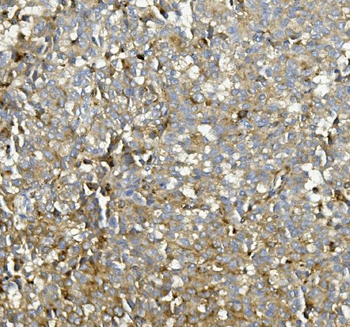 Anti-ASAH1 Antibody