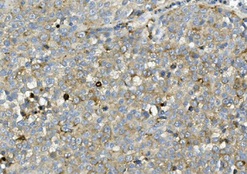 Anti-ASAH1 Antibody