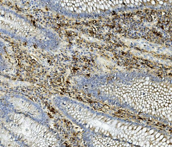 Anti-ASAH1 Antibody