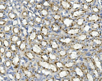 Anti-ASAH1 Antibody