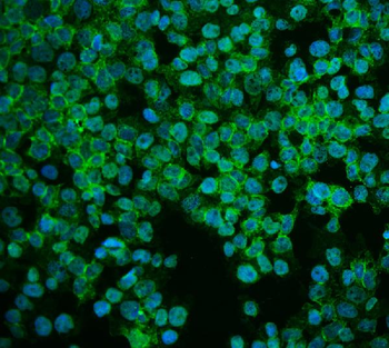 Anti-ASS1 Antibody