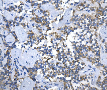 Anti-ASS1 Antibody