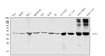 Anti-ASS1 Antibody