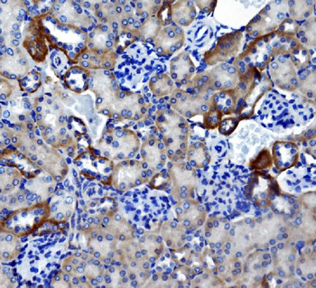 Carbonic Anhydrase 4/CA4 Antibody