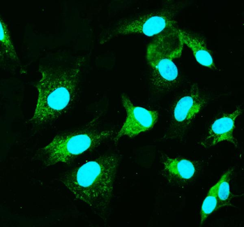 Anti-CARD9 Antibody