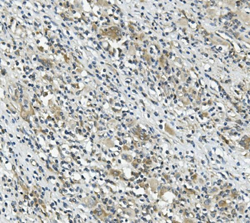 Anti-CARD9 Antibody
