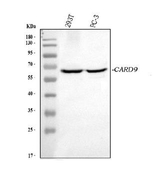 Anti-CARD9 Antibody
