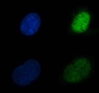 Anti-CBR1 Antibody