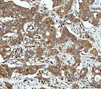 Anti-CBR1 Antibody