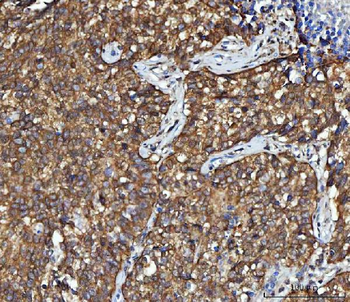 Anti-CBR1 Antibody