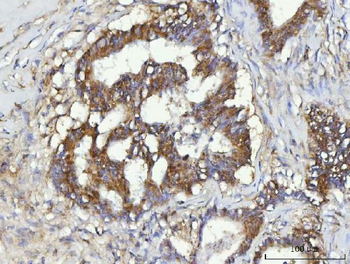 Anti-CBR1 Antibody