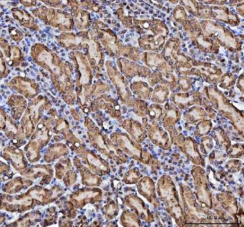 Anti-CBR1 Antibody