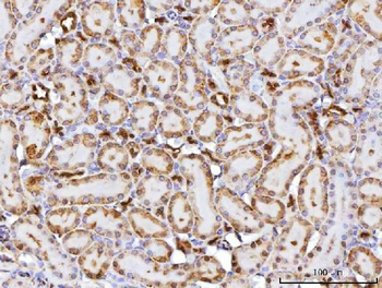 Anti-CBR1 Antibody
