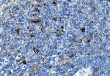 Anti-CCR2 Antibody